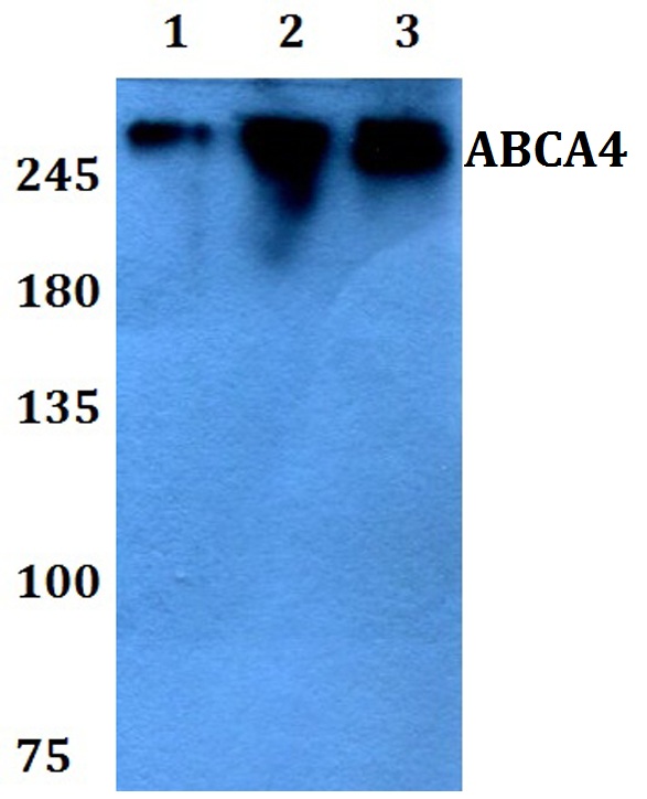 a01048 1 abca4 primary antiboties wb testing 1