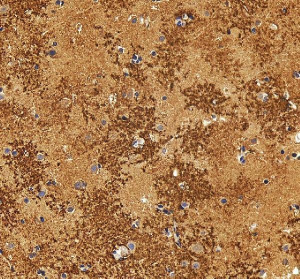 IHC analysis of Aquaporin 4/AQP4 using anti-Aquaporin 4/AQP4 antibody (A01049)