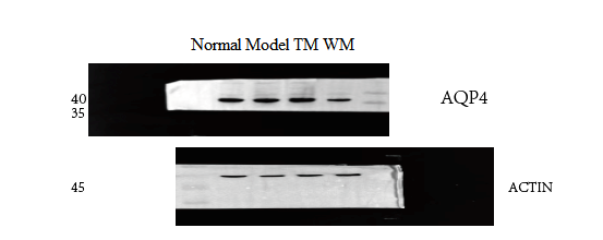 a01049 aqp4 primary antibodies wb testing 2
