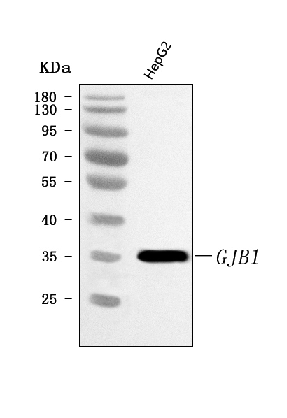  Western blot analysis of Connexin-32/GJB1 using anti-Connexin-32/GJB1 antibody (A01050)