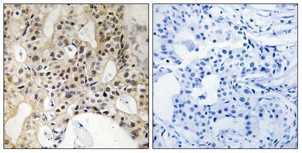 a01051 3 lats1 primary antibodies ihc testing 3