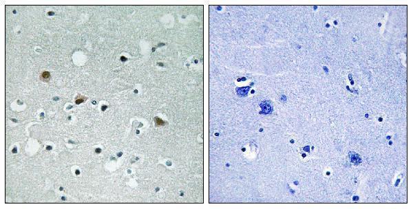 a01051t1079 lats1 primary antibodies ihc testing 2