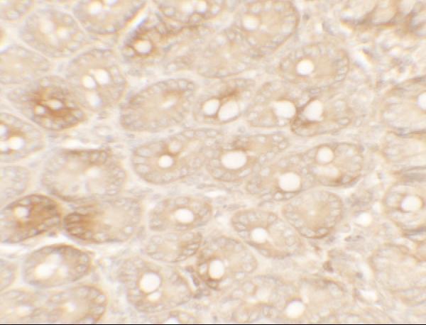 Immunohistochemistry of TFPI in rat small intestine tissue with TFPI antibody at 5 μg/mL