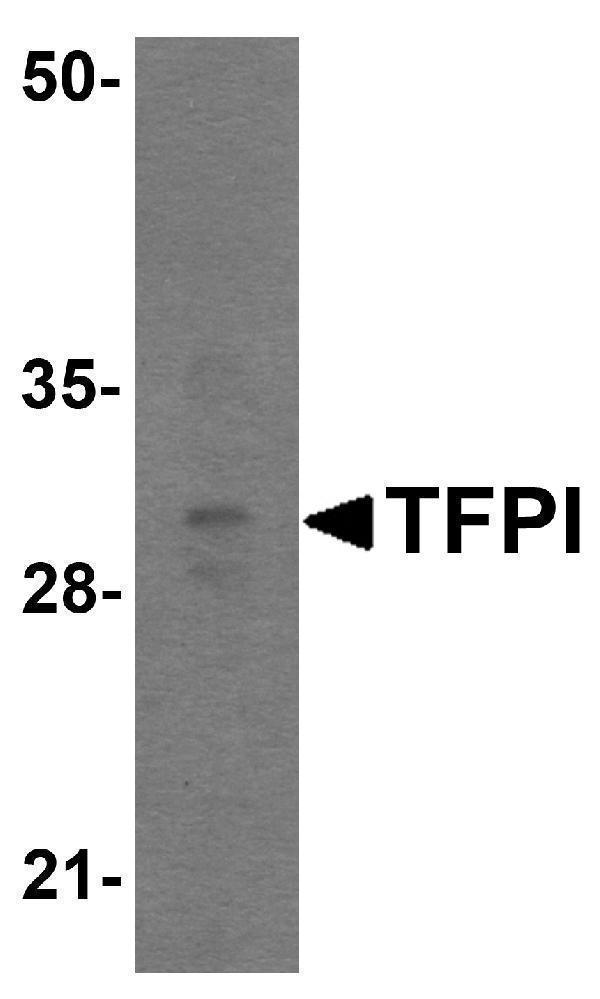 Western blot analysis of TFPI in rat small intestine tissue lysate with TFPI antibody at 1 μg/mL
