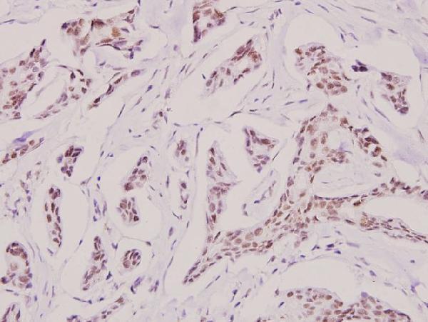 a01053 2 dcx primary antiboties ihc testing 2