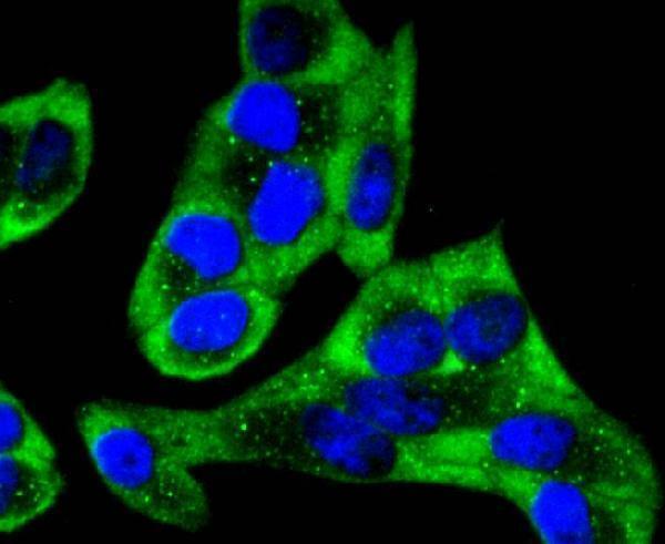 ICC staining YB1 in Hela cells (green)