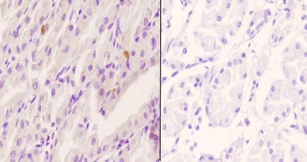 a01058s380 1 rps6ka1 primary antiboties ihc testing 4