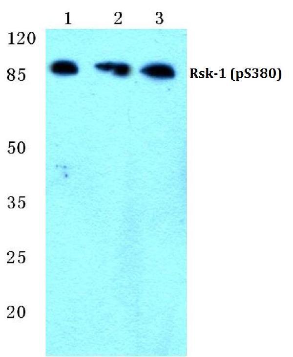 Western blot (WB) analysis of p-Rsk-1 (S380) polyclonal antibody at 1:500 dilution
Lane1:Hela cell lysate treated with PMA(100nM,15mins)
Lane2:NIH-3T3 cell lysate treated with PMA(100nM,15mins)
Lane3:PC12 cell lysate treated with PMA(100nM,15mins)