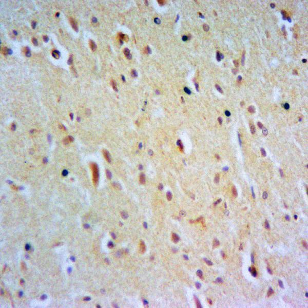 Immunohistochemistry of paraffin-embedded Rat Brain using p-Rsk-1 (S380)  antibody at dilution of 1:50