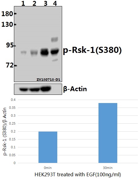 Western blot (WB) analysis of p-Rsk-1 (S380) pAb at 1:500 dilution
Lane1:HEK293T whole cell lysate(40ug)
Lane2:HEK293T treated with EGF(100ng/ml,30 minutes) whole cell lysate(40ug)
Lane3:The Spleen tissue lysate of Mouse(40ug)
Lane4:The Heart tissue lysate of Rat(40ug)