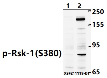 Western blot (WB) analysis of Rsk-1 (Phospho-S380) polyclonal antibody at 1:1000 dilution
Lane1:Hela treated with λ-phosphatase whole cell lysate(40ug)
Lane2:HeLa whole cell lysate(40ug)