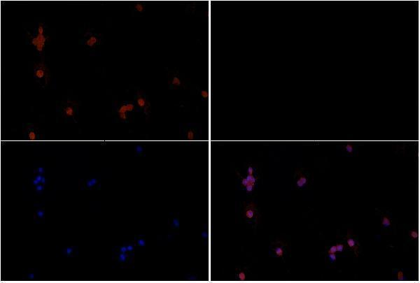 Immunofluorescence analysis of HCT116 cells using Rsk-1 antibody at dilution of 1:50