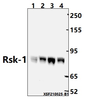 Western blot (WB) analysis of Rsk-1 (T353)  pAb at 1:2000 dilution
Lane1:C6 whole cell lysate(40ug)
Lane2:HCT116 whole cell lysate(40ug)
Lane3:Jurkat whole cell lysate(40ug)                                                                                           
Lane4:H1792 whole cell lysate(40ug)