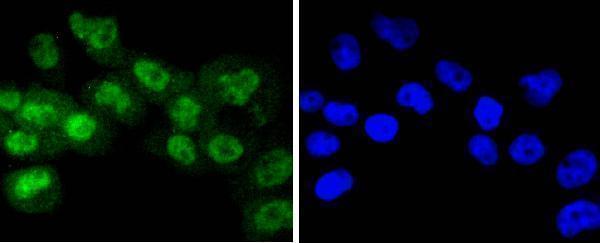 ICC staining Phospho-RSK1 p90(T359+S363) in A431 cells (green)