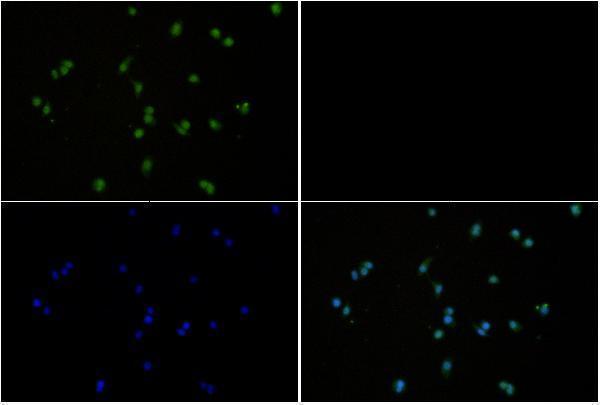 Immunofluorescence analysis of CT26 cells using Rsk-1 (phospho-T359/S363) antibody at dilution of 1:50