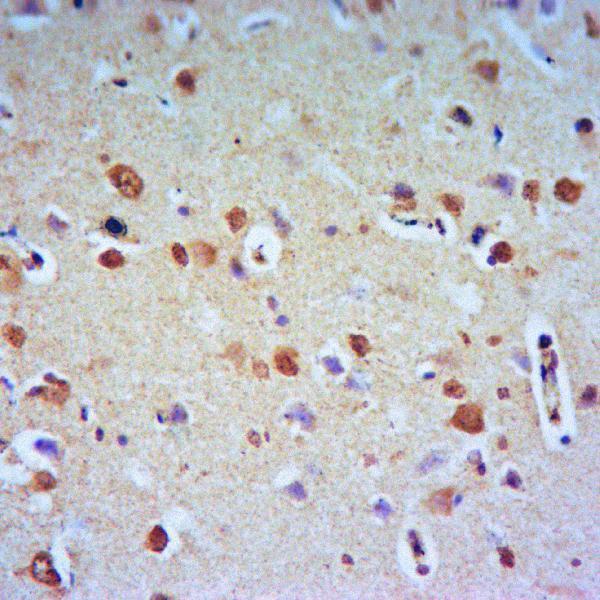 a01058t359s363 rps6ka1 primary antiboties ihc testing 4