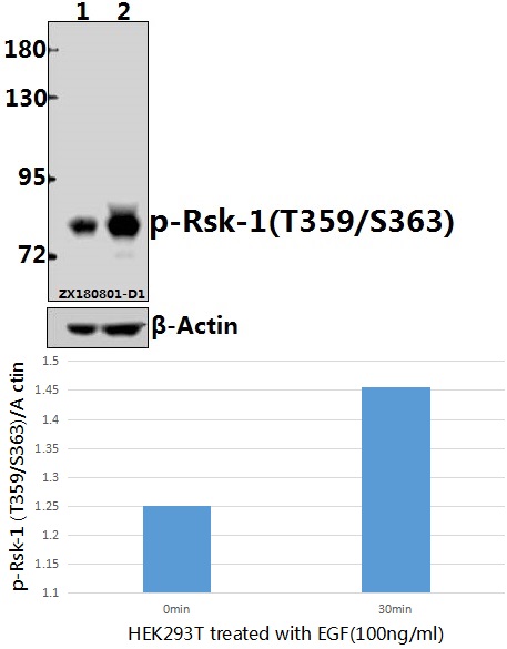 Western blot (WB) analysis of p-Rsk-1 (T359/S363) pAb at 1:2000 dilution
Lane1:HEK293T whole cell lysate(40ug)
Lane2:HEK293T treated with EGF(100ng/ml,30 minutes) whole cell lysate(40ug)