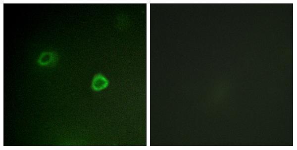 a01058t573 rps6ka1 primary antibodies if testing 5