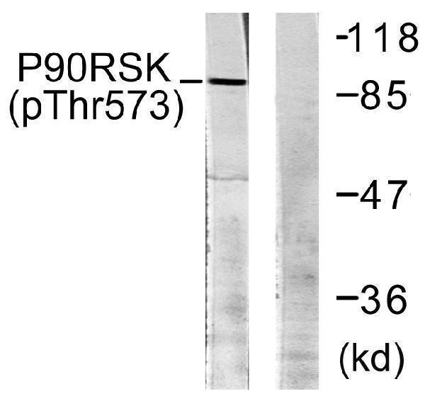 Western blot analysis of lysates from 293 cells treated with UV 30', using p90 RSK (Phospho-Thr573) Antibody