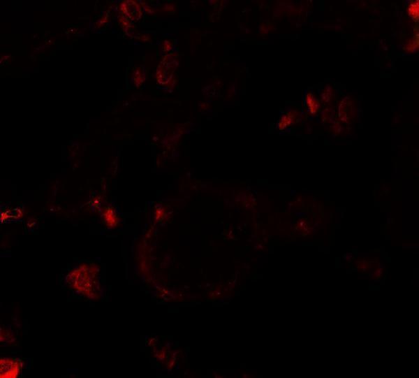 Immunofluorescence of VKORC1 in human lung tissue with VKORC1 antibody at 20 μg/mL