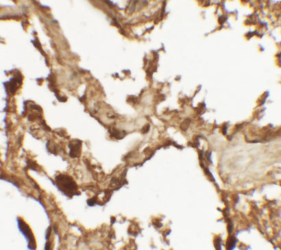 Immunohistochemistry of VKORC1 in human lung tissue with VKORC1 antibody at 2