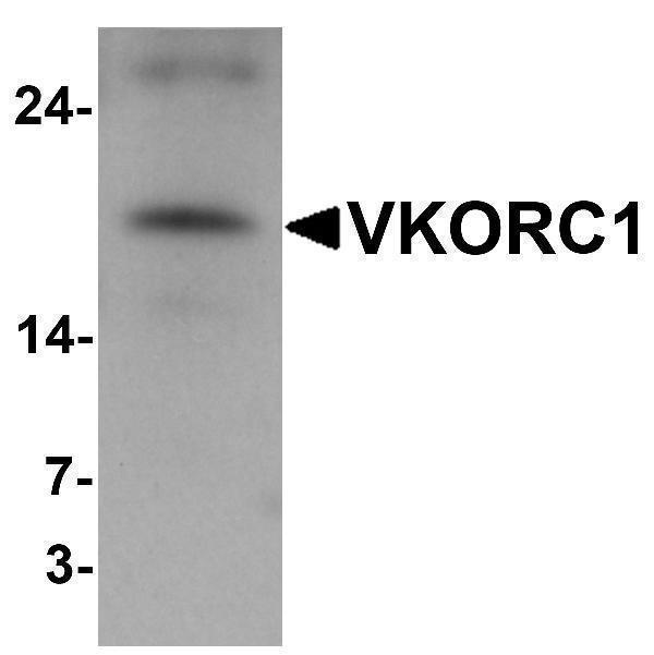 Western blot analysis of VKORC1 in A549 cell lysate with VKORC1 antibody at 1 μg/mL