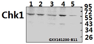 Western blot (WB) analysis of Chk1 (K274) polyclonal antibody at 1:500 dilution
Lane1:HepG2 whole cell lysate(40ug)
Lane2:SGC7901 whole cell lysate(40ug)
Lane3:HCT116 whole cell lysate(40ug)
Lane4:HEK293T whole cell lysate(40ug)
Lane5:A549 whole cell lysate(40ug)