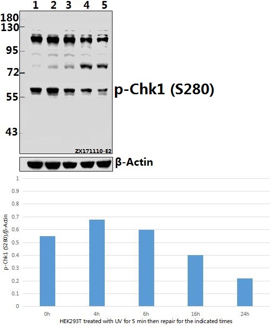 Western blot (WB) analysis of Chk1 (phospho-S280) polyclonal antibody at 1:500 dilution
Lane1:HEK293T whole cell lysate(40ug)
Lane2:HEK293T treated with UV for 5 minutes then repair for 4 hours whole cell lysate(40ug)
Lane3:HEK293T treated with UV for 5 minutes then repair for 6 hours whole cell lysate(40ug)
Lane4:HEK293T treated with UV for 5 minutes then repair for 16 hours whole cell lysate(40ug)
Lane5:HEK293T treated with UV for 5 minutes then repair for 24 hours whole cell lysate(40ug)