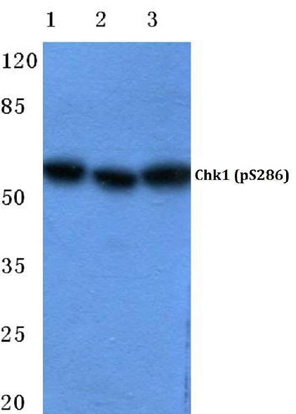 Western blot (WB) analysis of p-Chk1 (S286) polyclonal antibody at 1:500 dilution
Lane1:Hela cell lysate
Lane2:NIH-3T3 cell lysate
Lane3:H9C2 cell lysate