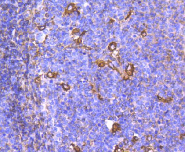 a01060s296 chek1 primary antiboties ihc testing 1