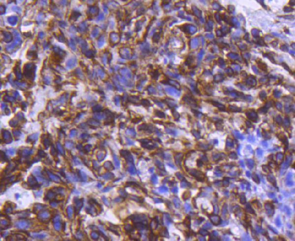 a01060s296 chek1 primary antiboties ihc testing 2