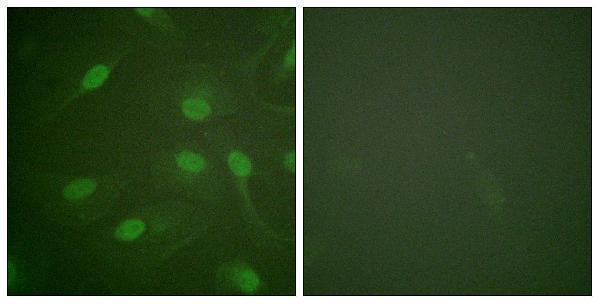 Immunofluorescence analysis of HeLa cells, using Chk1 (Phospho-Ser301) Antibody
