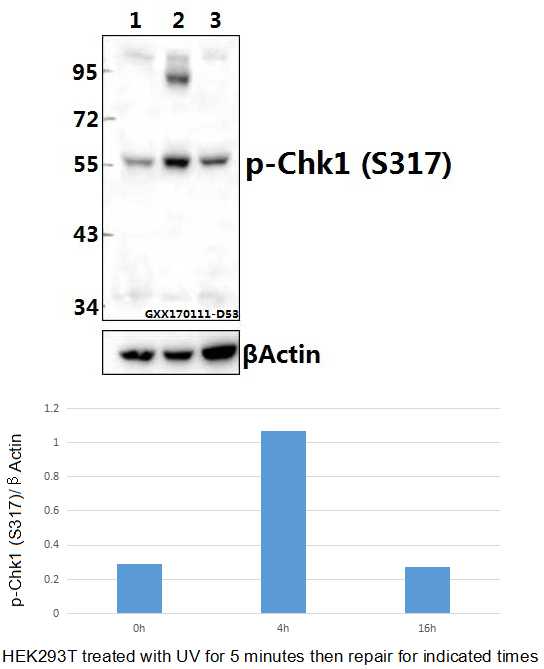 Western blot (WB) analysis of Chk1 (phospho-S317) polyclonal antibody at 1:500 dilution
Lane1:HEK293T  whole cell lysate
Lane2:HEK293T treated with UV for 5 minutes then repair for 4 hours whole cell lysate
Lane3:HEK293T treated with UV for 5 minutes then repair for 16 hours whole cell lysate
