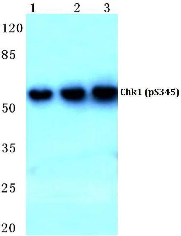 Western blot (WB) analysis of p-Chk1 (S345) polyclonal antibody at 1:500 dilution
Lane1:Hela cell lysate
Lane2:Mouse brain tissue lysate
Lane3:Rat brain tissue lysate