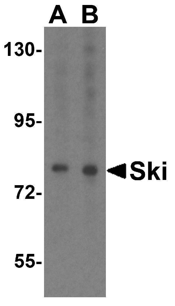 Western blot analysis of Ski in HeLa cell lysate with Ski antibody at (A) 1 and (B) 2 μg/mL