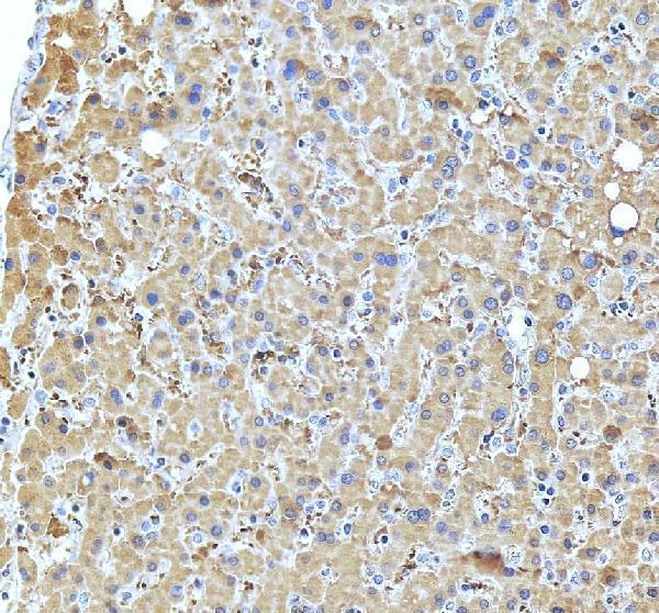 a01064 1 tnfrsf11a primary antibodies ihc testing 4