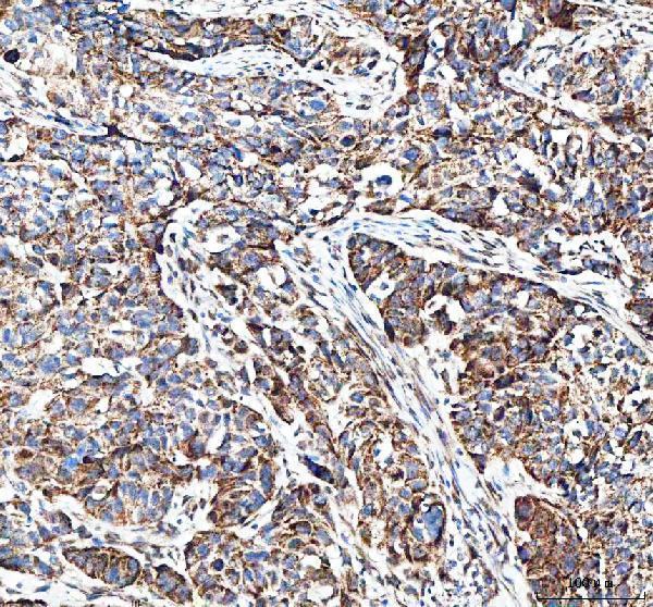 a01065 mut primary antibodies ihc testing 1
