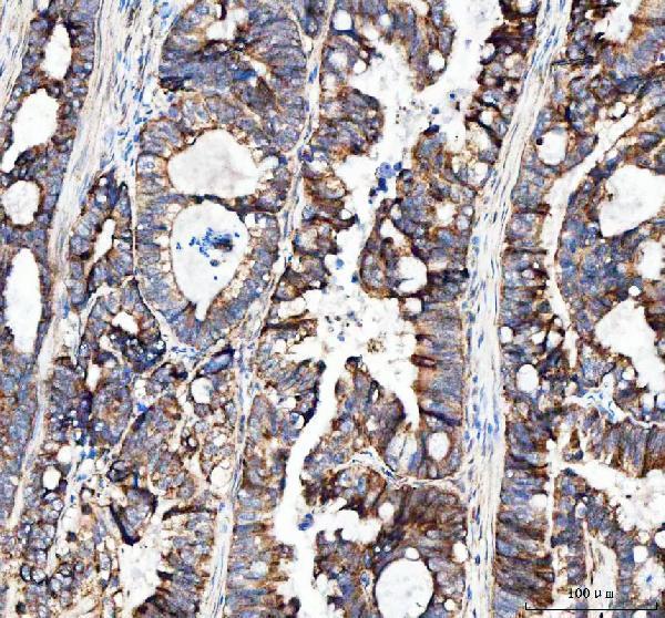 a01065 mut primary antibodies ihc testing 2