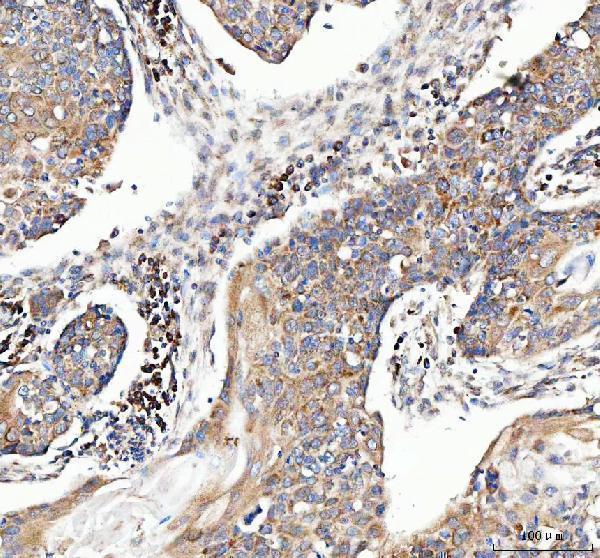 a01065 mut primary antibodies ihc testing 3
