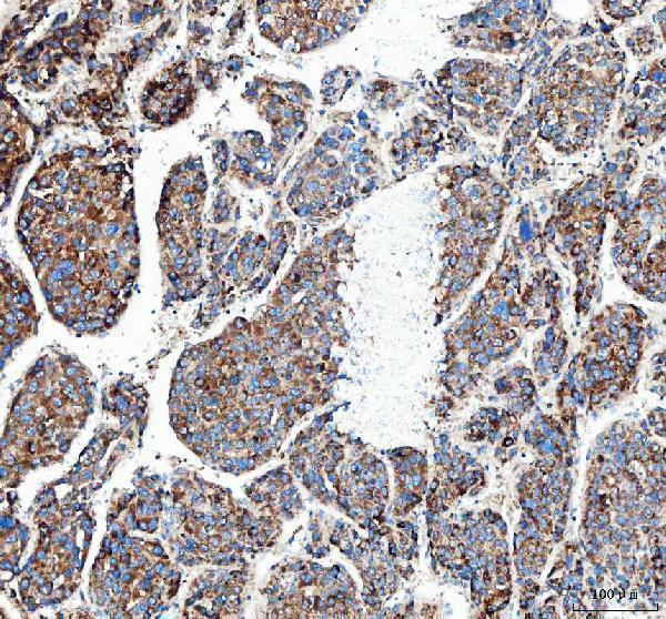 a01065 mut primary antibodies ihc testing 4
