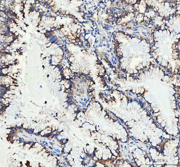 a01065 mut primary antibodies ihc testing 5