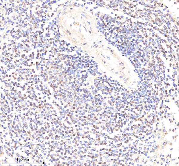  IHC analysis of PYK2/PTK2B using anti-PYK2/PTK2B antibody (A01066-1)