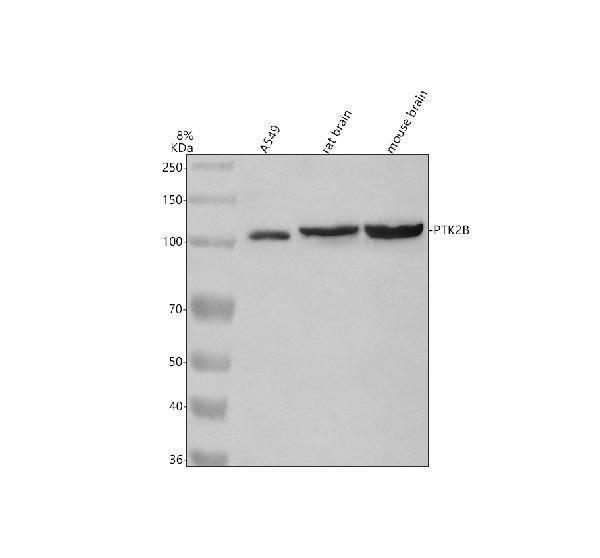  Western blot analysis of PYK2/PTK2B using anti-PYK2/PTK2B antibody (A01066-1)