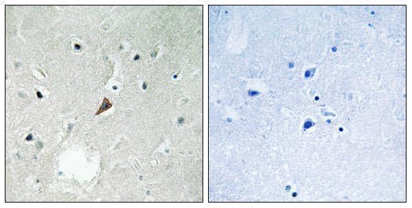 a01066y579 ptk2b primary antibodies ihc testing 1