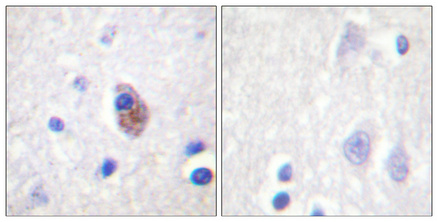 a01066y881 ptk2b primary antibodies ihc testing 4