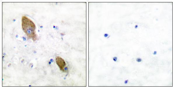 a01066y881 ptk2b primary antibodies ihc testing 5