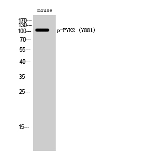 a01066y881 ptk2b primary antibodies wb testing 2