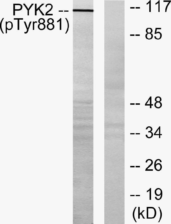 a01066y881 ptk2b primary antibodies wb testing 3