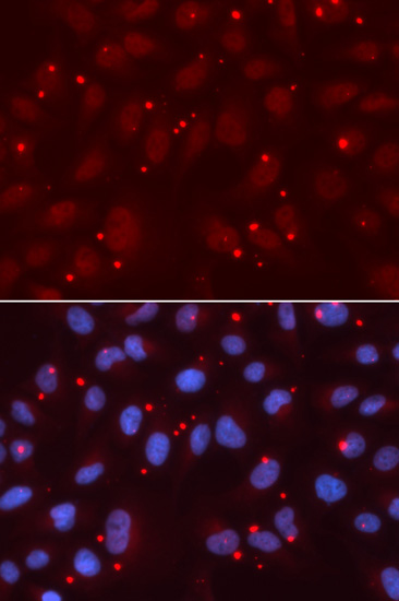 Immunofluorescence analysis of U2OS cells, using XRCC3 polyclonal antibody