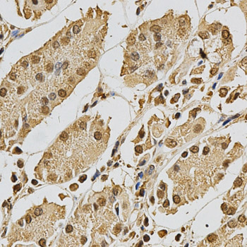 Immunohistochemistry (IHC) analysis of XRCC3 polyclonal antibody in paraffin-embedded Human Stomach tissue